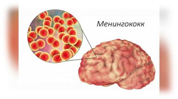 Вспышка менингококковой инфекции B в Великобритании